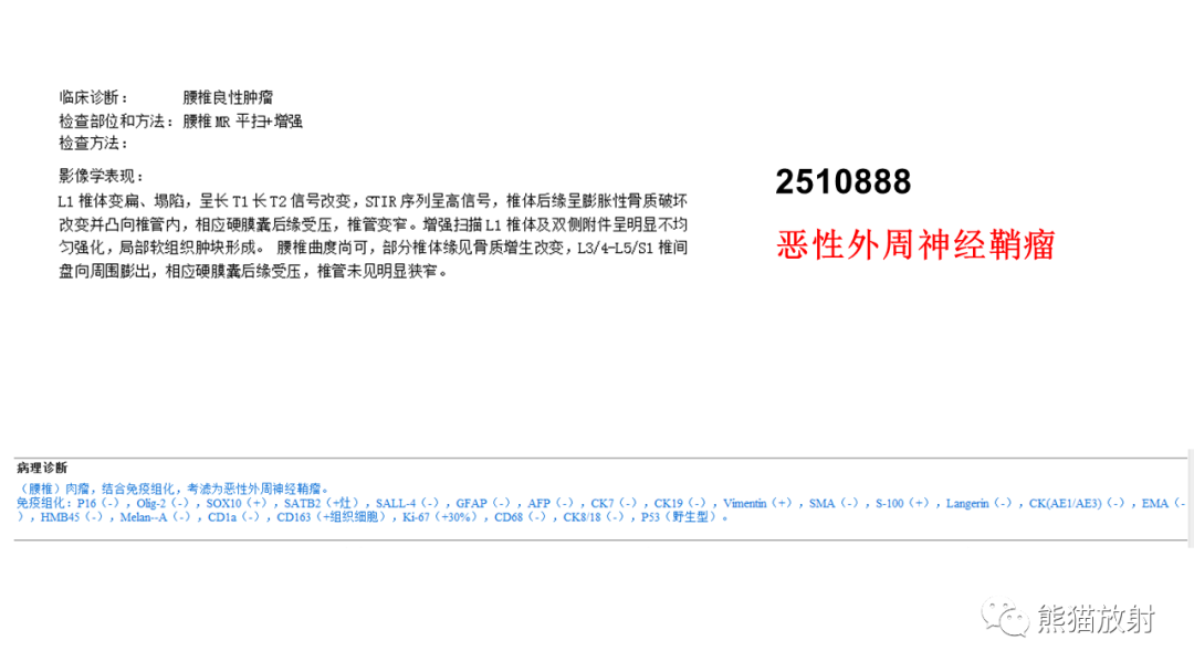 【病例】椎体恶性外周神经鞘瘤 VS 浆细胞瘤-11