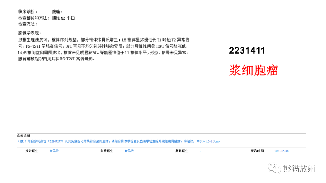 【病例】椎体恶性外周神经鞘瘤 VS 浆细胞瘤-12