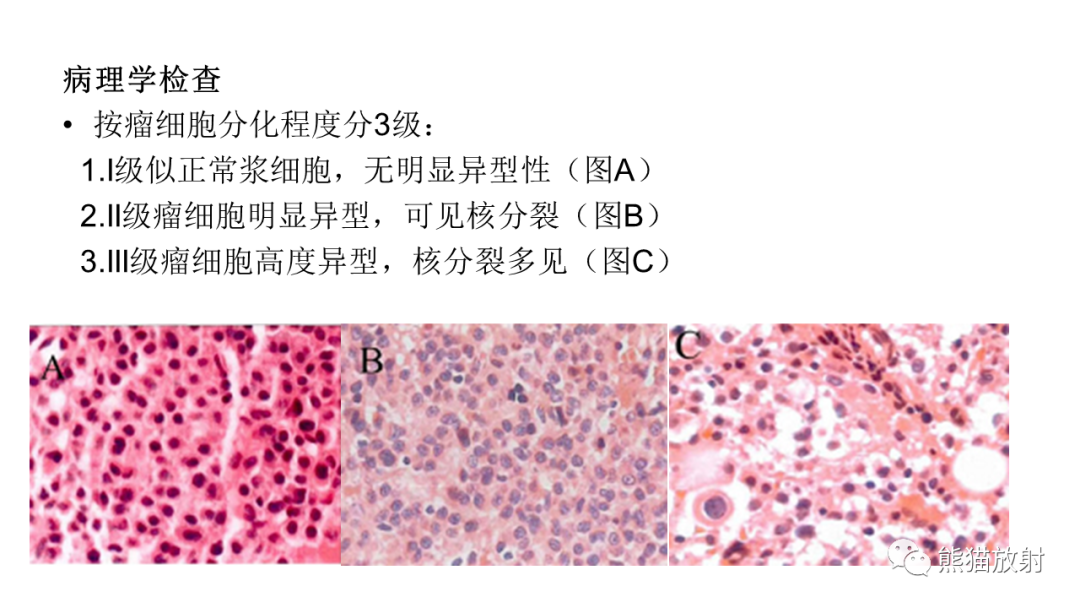 【病例】椎体恶性外周神经鞘瘤 VS 浆细胞瘤-20