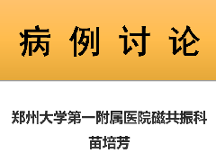 室管膜下巨细胞星形细胞瘤1例MR影像