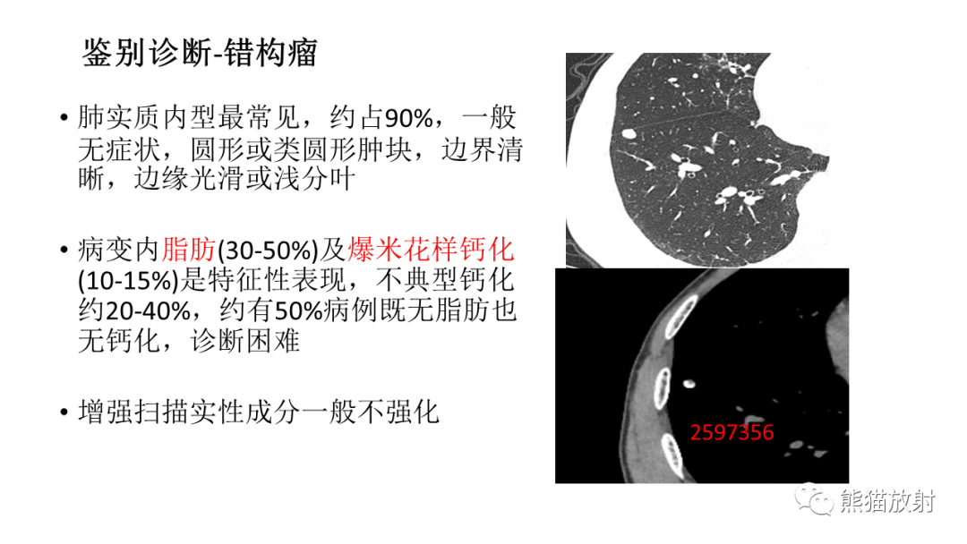 【病例】肺腺癌 VS 炎性肌纤维母细胞瘤-28