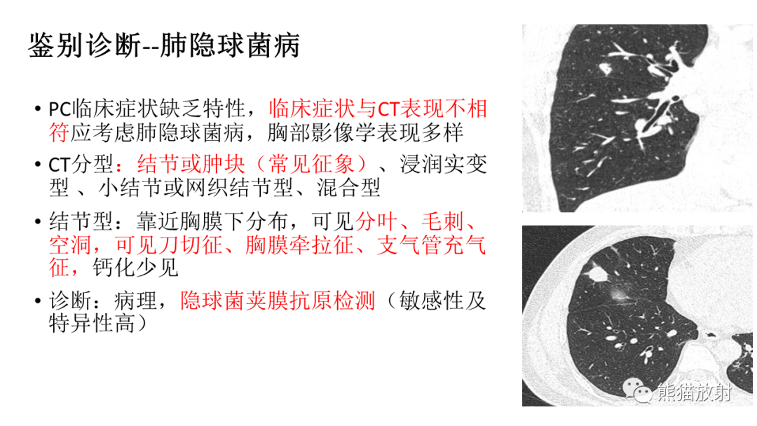 【病例】肺腺癌 VS 炎性肌纤维母细胞瘤-33