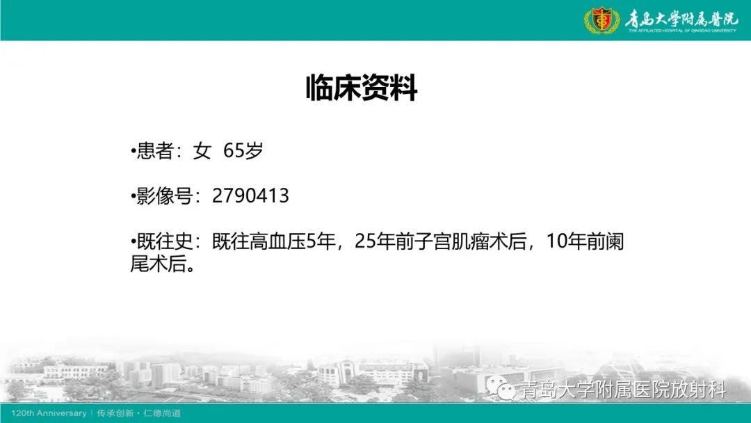 【病例】Wernicke脑病1例MR影像-2