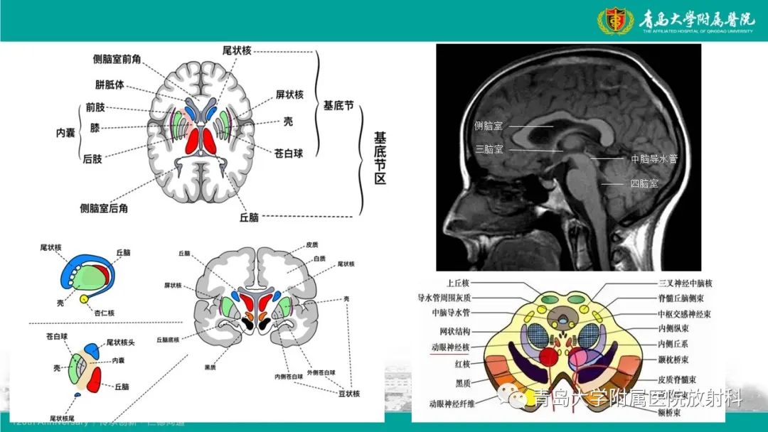 【病例】Wernicke脑病1例MR影像-10
