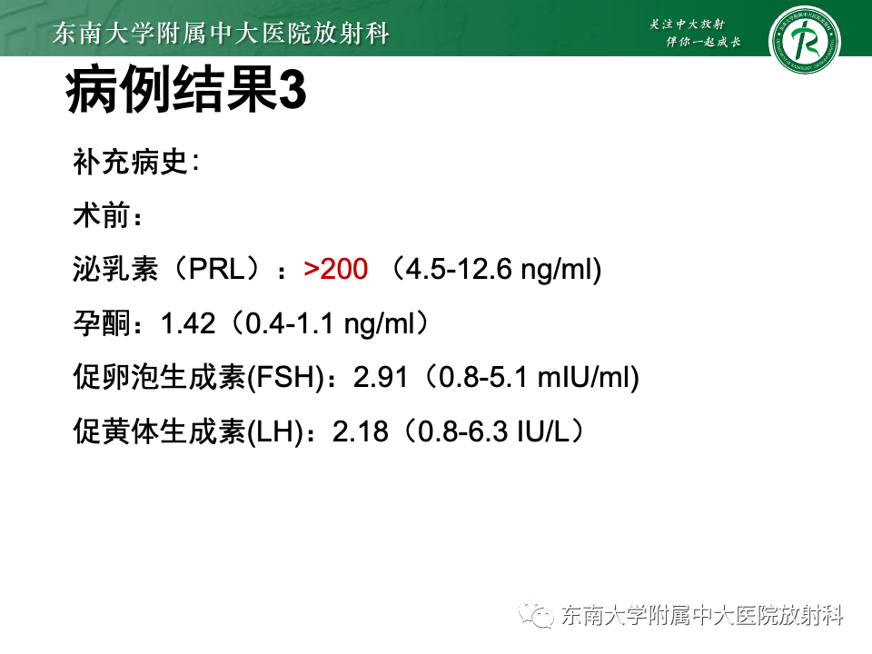 【PPT】斜坡骨质破坏性病变影像诊断-15