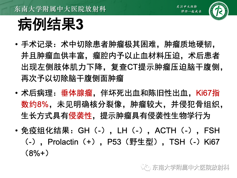 【PPT】斜坡骨质破坏性病变影像诊断-16