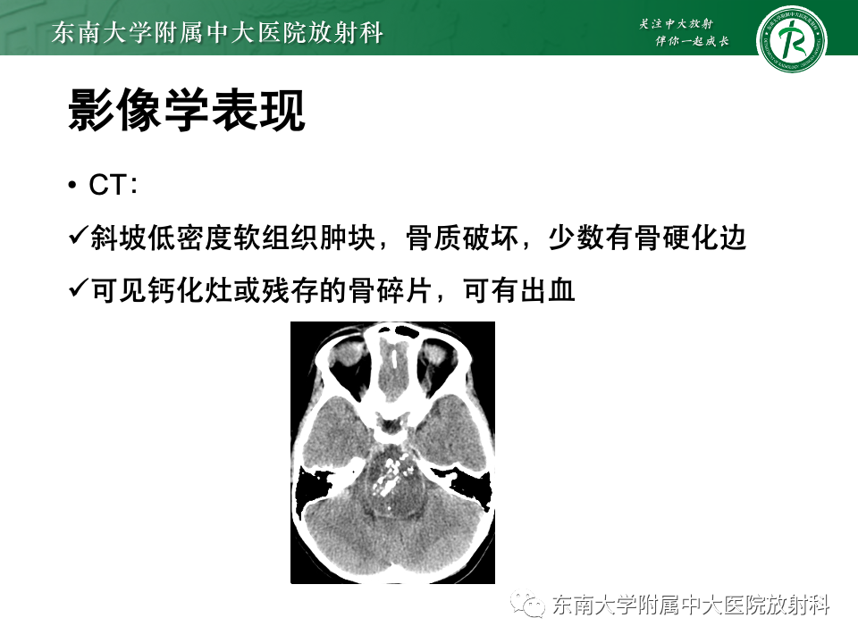 【PPT】斜坡骨质破坏性病变影像诊断-26