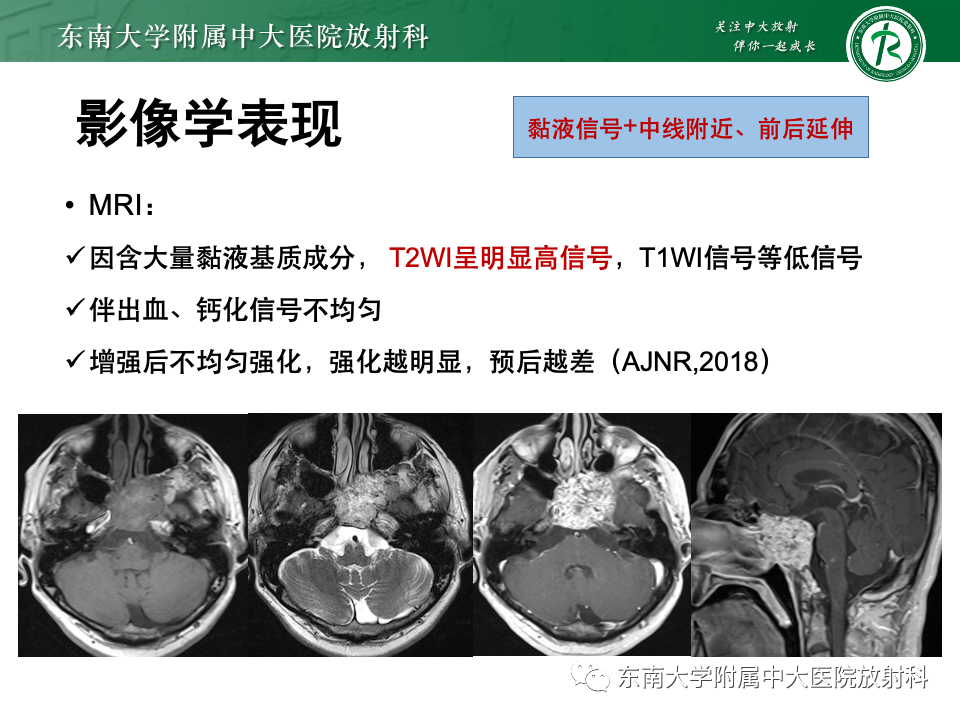 【PPT】斜坡骨质破坏性病变影像诊断-27
