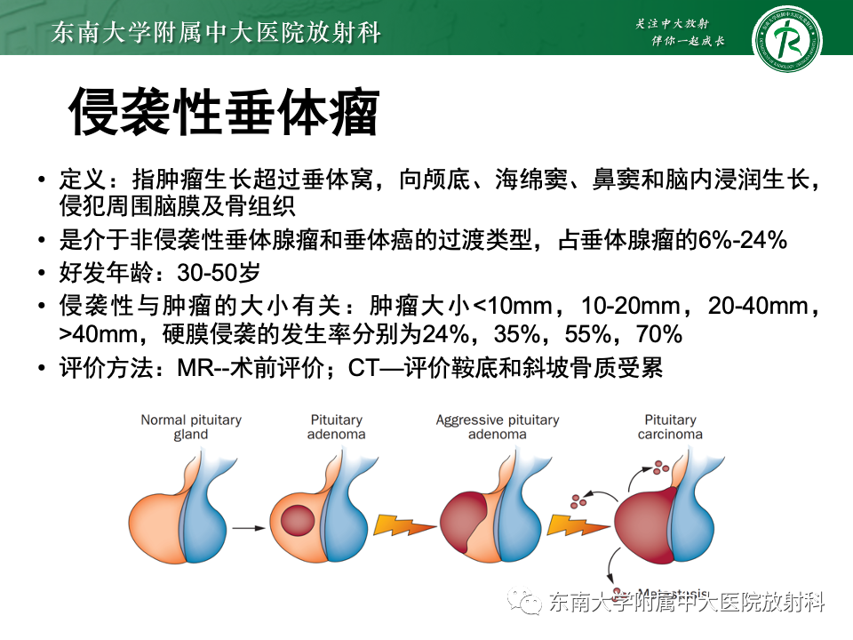 【PPT】斜坡骨质破坏性病变影像诊断-35