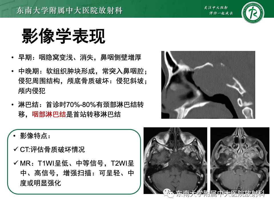 【PPT】斜坡骨质破坏性病变影像诊断-41