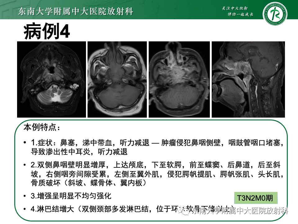 【PPT】斜坡骨质破坏性病变影像诊断-45