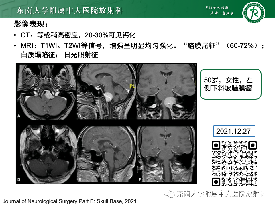 【PPT】斜坡骨质破坏性病变影像诊断-47