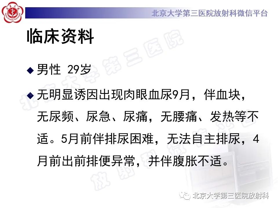 【PPT】前列腺肉瘤-2