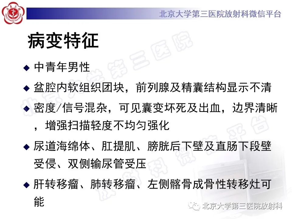 【PPT】前列腺肉瘤-11