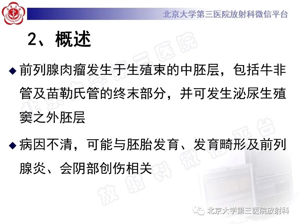 【PPT】前列腺肉瘤-16