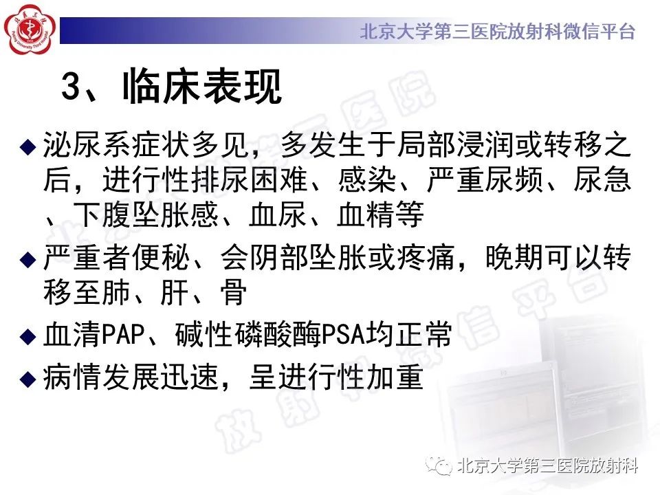 【PPT】前列腺肉瘤-17