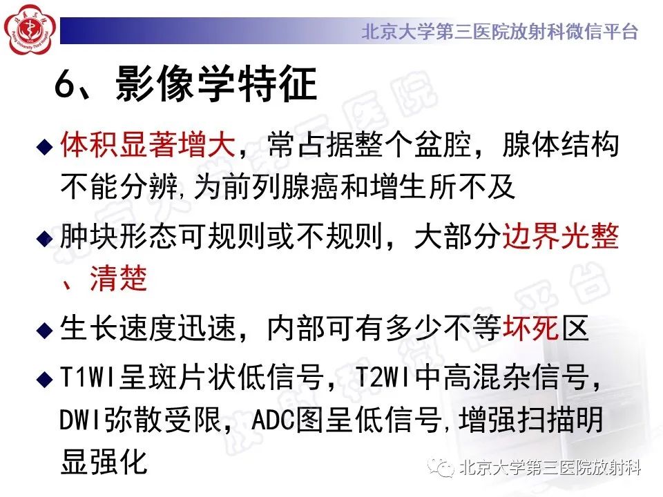 【PPT】前列腺肉瘤-20