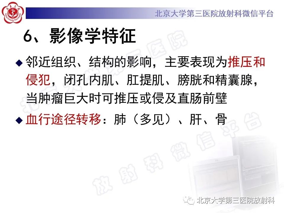 【PPT】前列腺肉瘤-21