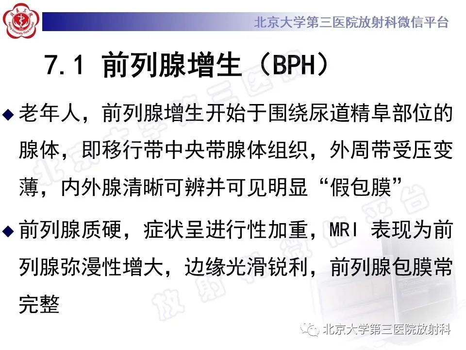 【PPT】前列腺肉瘤-25