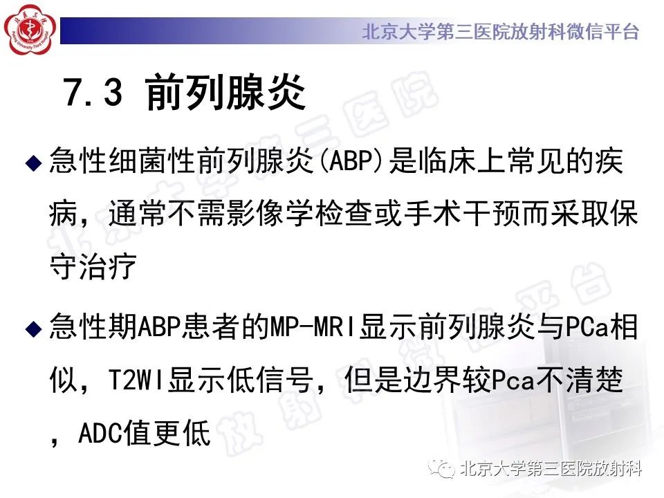 【PPT】前列腺肉瘤-31