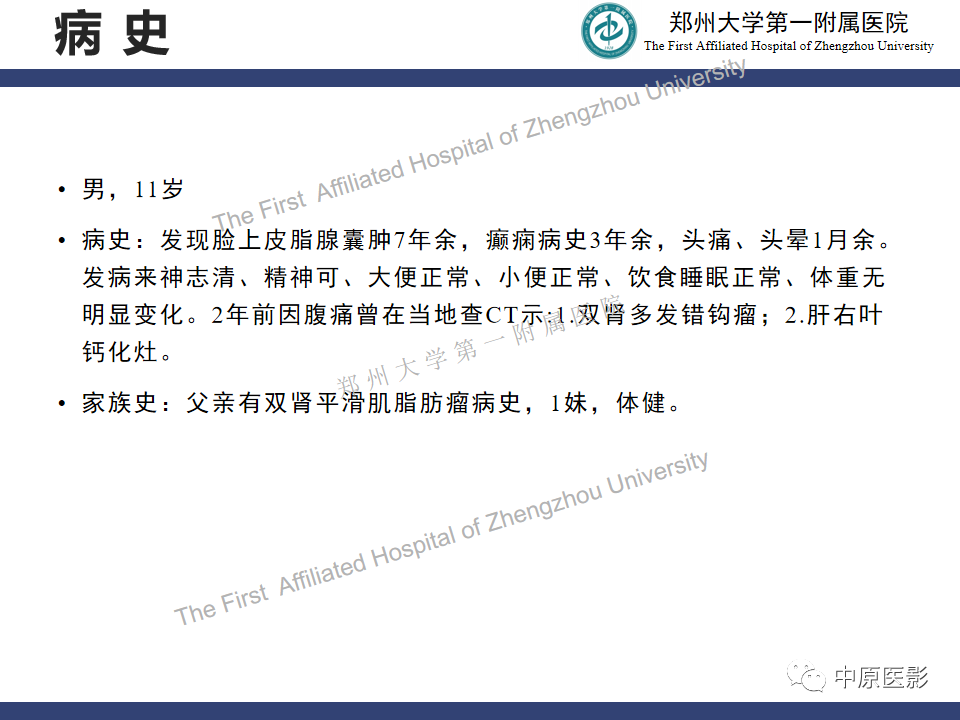 【病例】室管膜下巨细胞星形细胞瘤1例MR影像-2