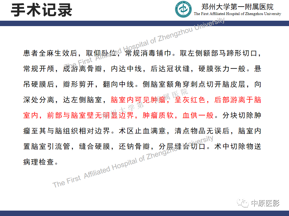 【病例】室管膜下巨细胞星形细胞瘤1例MR影像-8