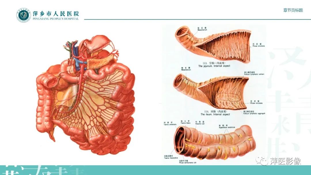 【PPT】肠梗阻读片之小肠篇-4