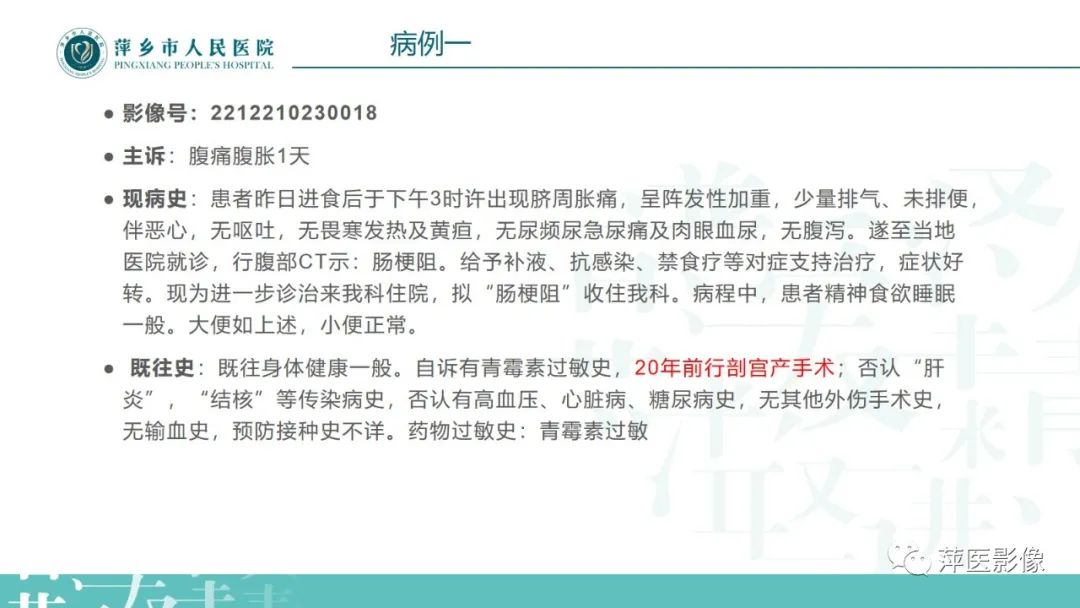 【PPT】肠梗阻读片之小肠篇-50