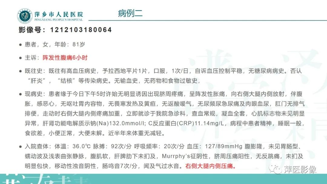 【PPT】肠梗阻读片之小肠篇-53