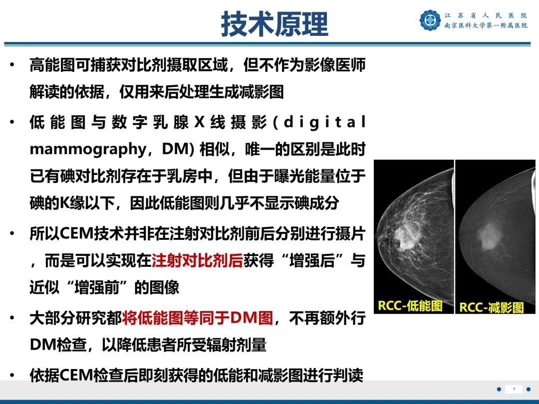 【PPT】浸润性乳腺癌，非特殊类型-8
