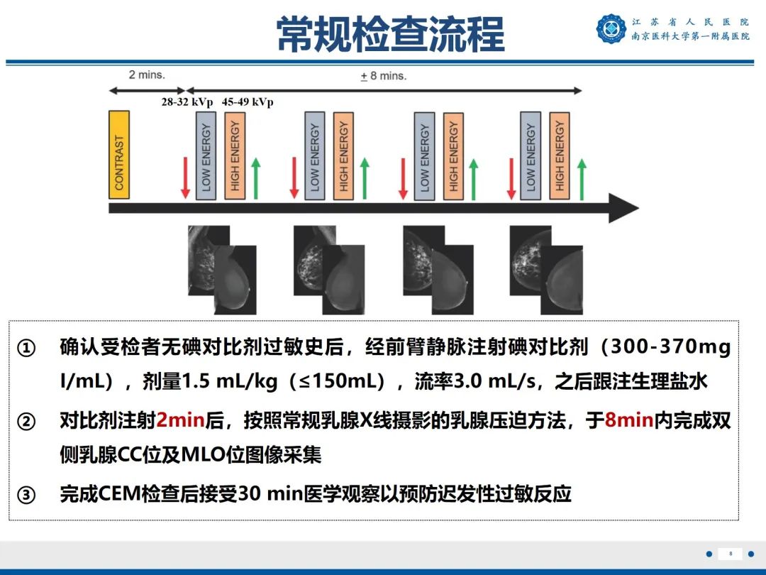【PPT】浸润性乳腺癌，非特殊类型-9