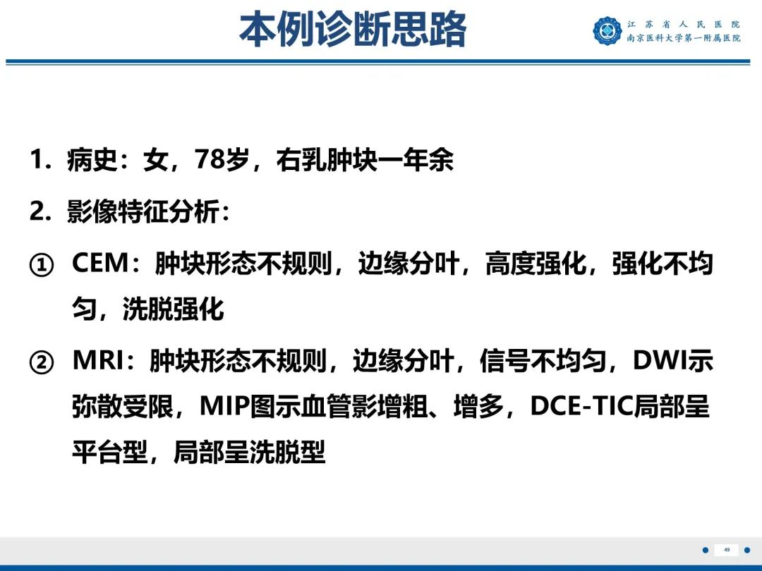 【PPT】浸润性乳腺癌，非特殊类型-50