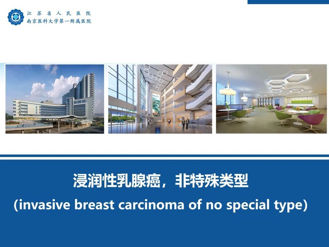 【PPT】浸润性乳腺癌，非特殊类型-54