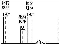 液体衰减反转恢复(FLAIR)序列图像有何特点