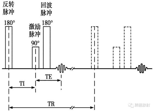 液体衰减反转恢复(FLAIR)序列图像有何特点-1
