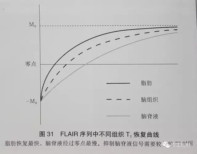 液体衰减反转恢复(FLAIR)序列图像有何特点-2