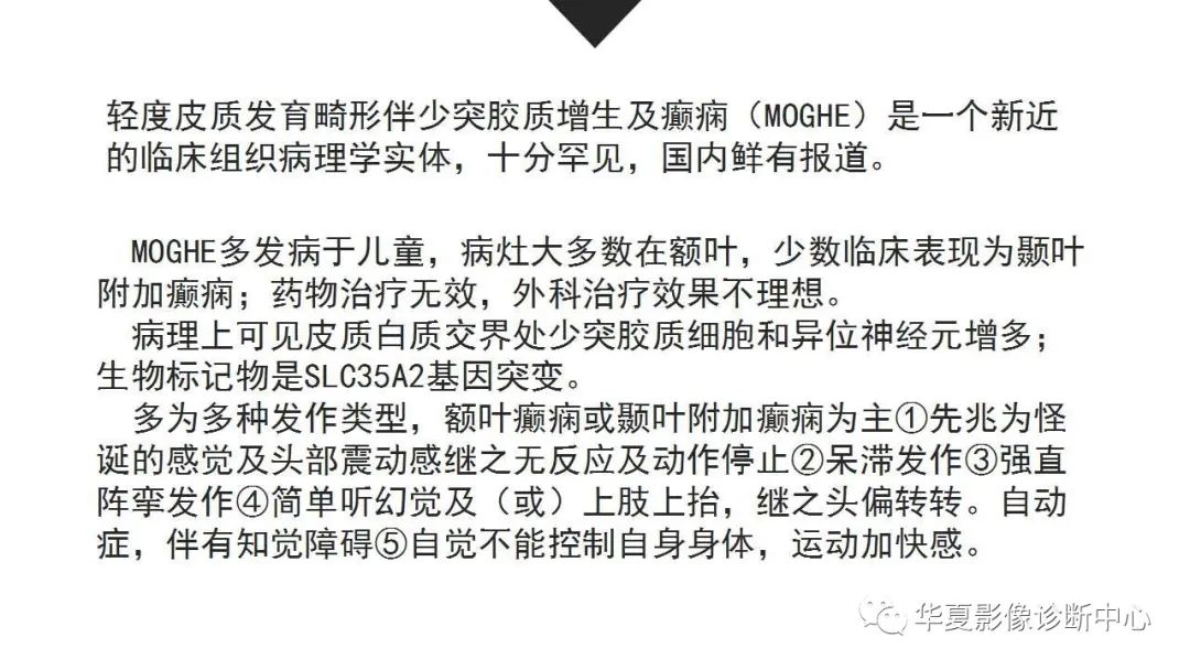 MOGHE的MRI诊断与鉴别诊断-2