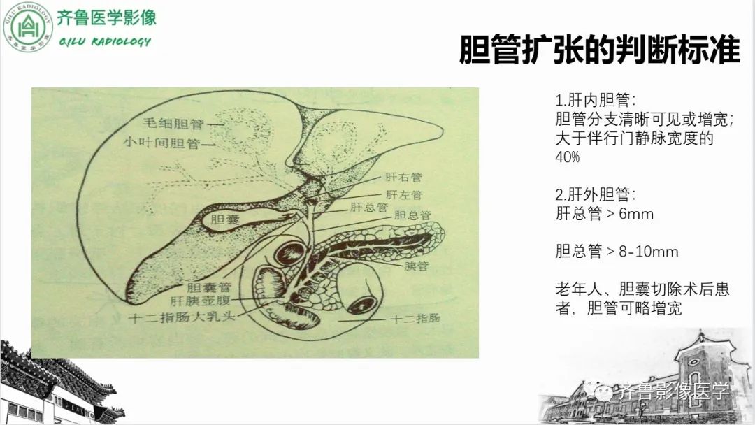 【PPT】先天性胆管扩张症-4