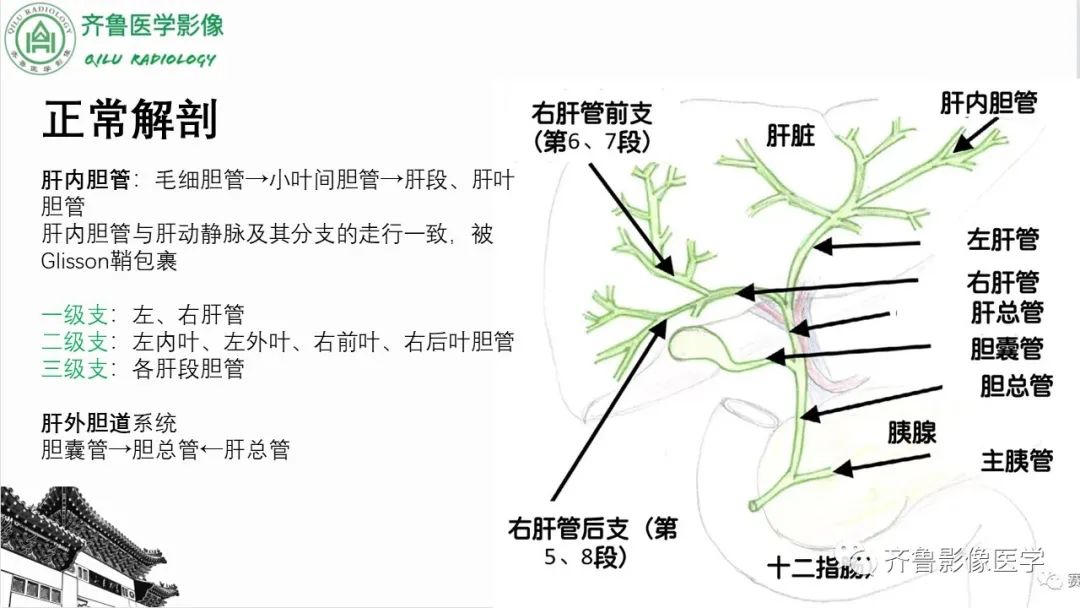 【PPT】先天性胆管扩张症-2
