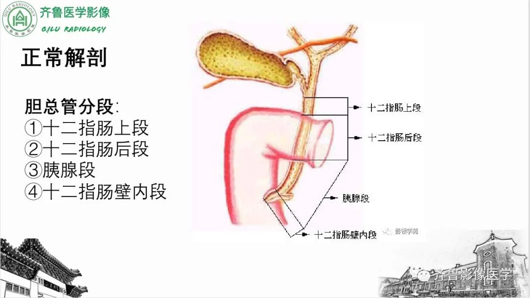 【PPT】先天性胆管扩张症-3