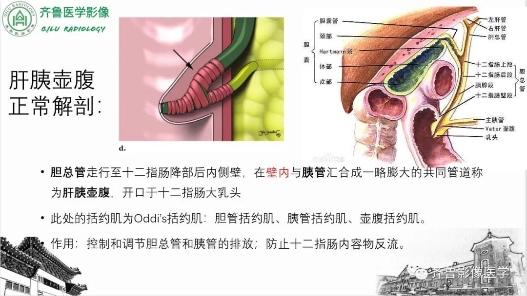 【PPT】先天性胆管扩张症-7