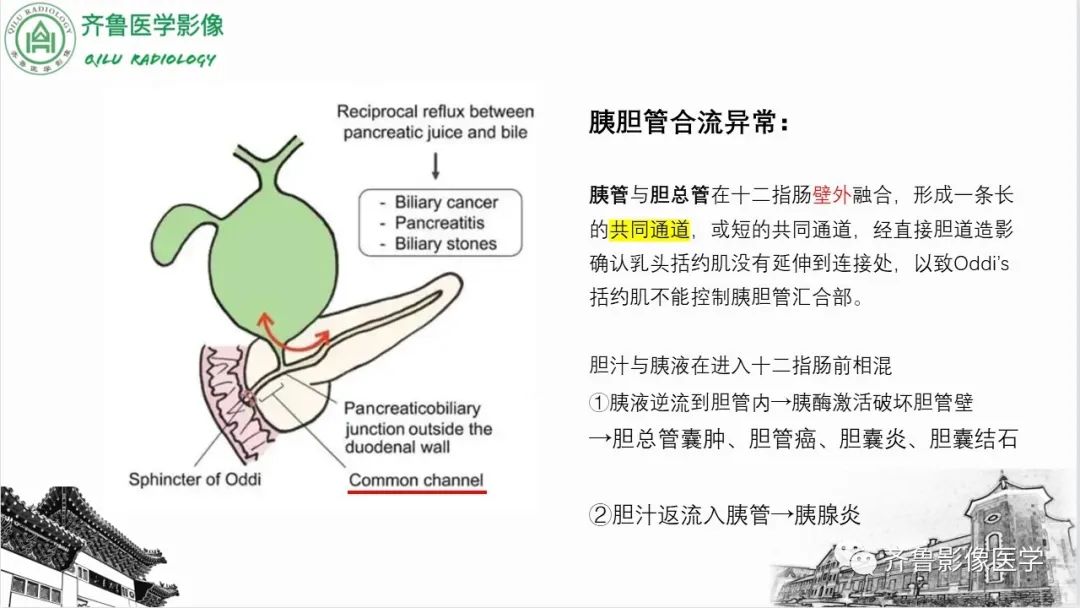 【PPT】先天性胆管扩张症-8