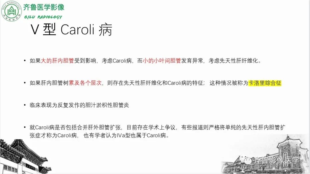 【PPT】先天性胆管扩张症-21