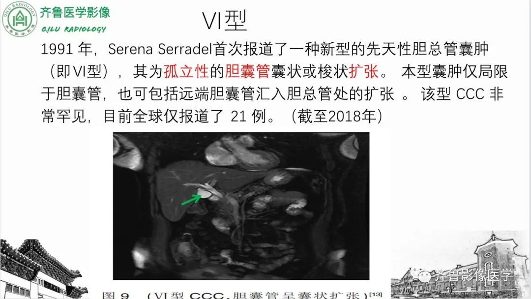 【PPT】先天性胆管扩张症-27