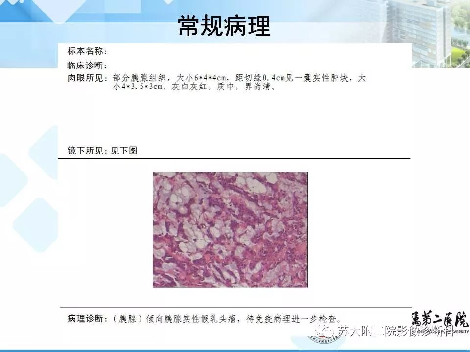 【病例】胰腺囊性病变3例影像诊断-9