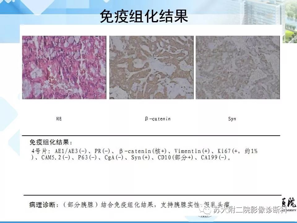 【病例】胰腺囊性病变3例影像诊断-10