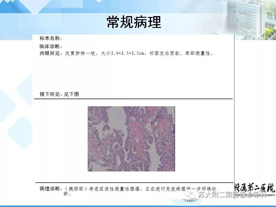 【病例】胰腺囊性病变3例影像诊断-19