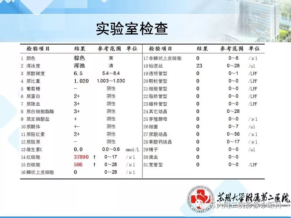 【病例】胰腺囊性病变3例影像诊断-27