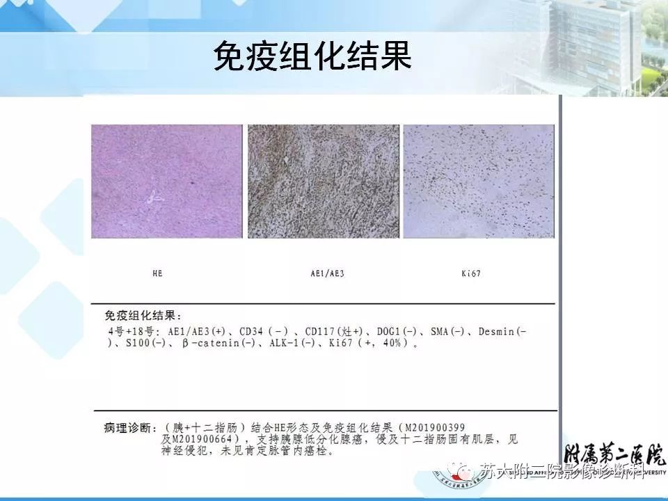【病例】胰腺囊性病变3例影像诊断-30