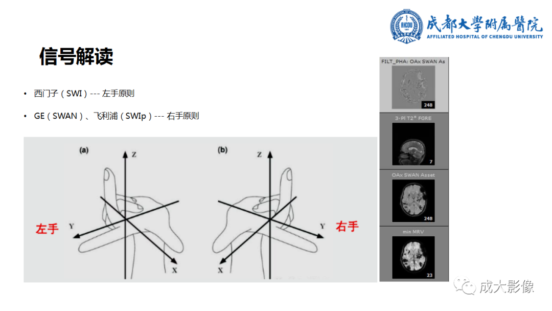 【PPT】SWI在中枢神经系统疾病中的应用-3